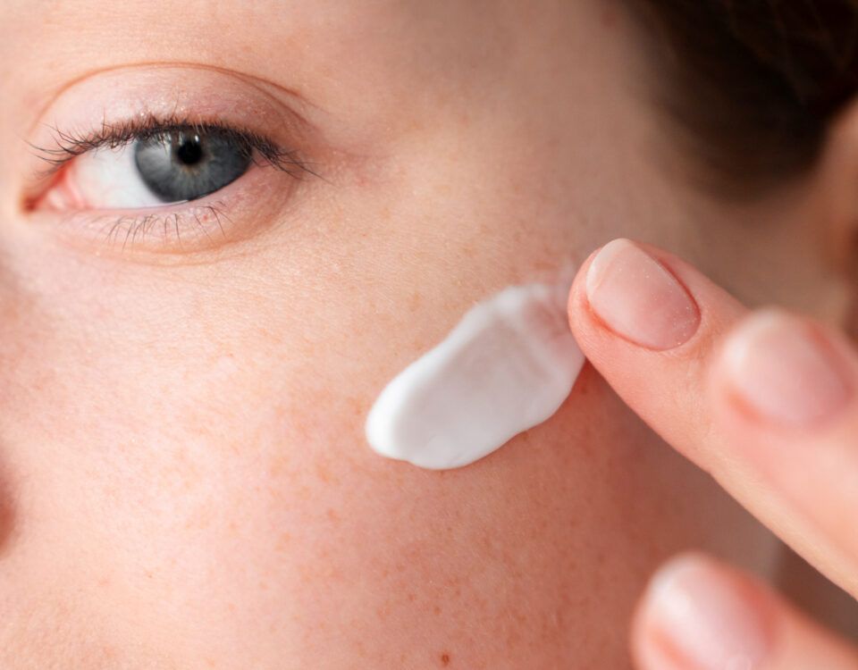 cea-mai-buna-crema-pentru-pete-pigmentare